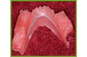Bite Mold — Dentures in Yandina, Queensland