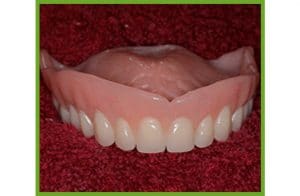 Denture Fit — Dentures in Yandina, Queensland