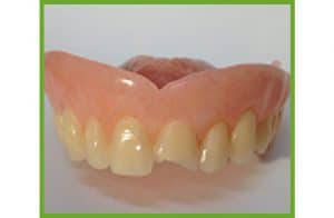 Replace Tooth Wire — Dentures in Yandina, Queensland